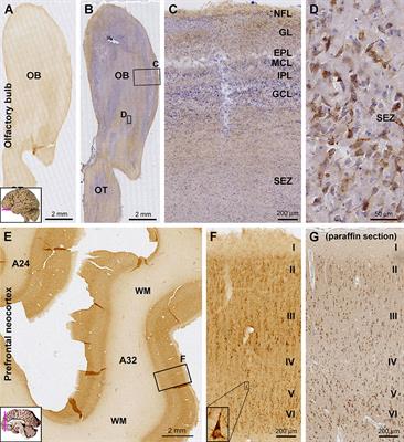 Regional and Cellular Mapping of Sortilin Immunoreactivity in Adult Human Brain